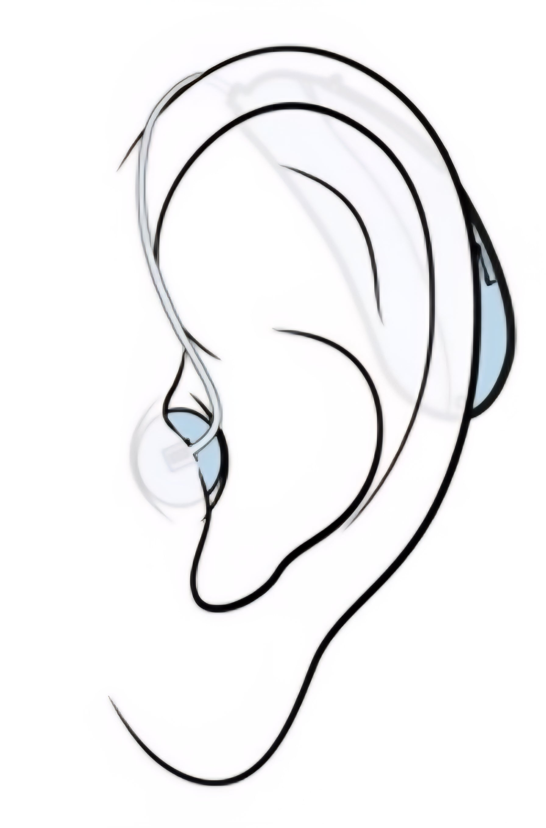 Sennheiser - All-Day Clear - OTC Self-Fitting Hearing Aid for Mild to Moderate Hearing Loss – All-Day Wear & Bluetooth - Gray Model: All-Day Clear ADC1 SKU: 10756115 Mild to Moderate Hearing Loss – All-Day Wear & Bluetooth